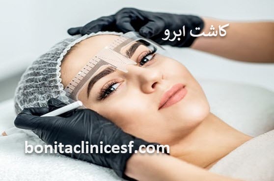 کاشت ابرو | کلینیک بنیتا اصفهان