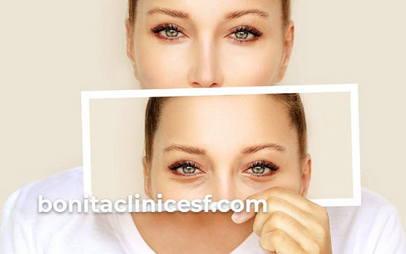 شرایط جسمانی مطلوب برای عمل بلفاروپلاستی | کلینیک بنیتا اصفهان