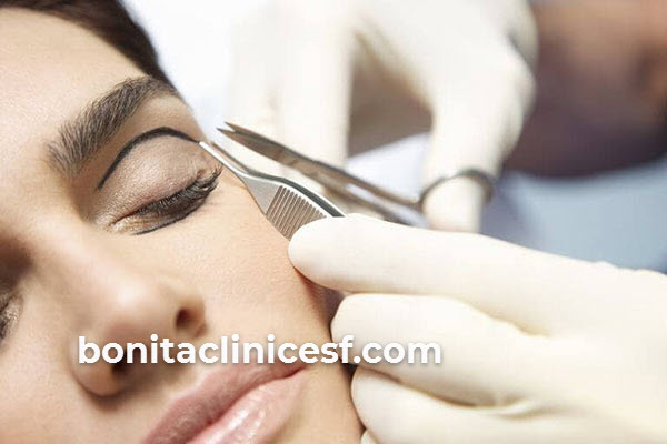 بهترین کاندیدهای عمل بلفاروپلاستی | کلینیک بنیتا اصفهان