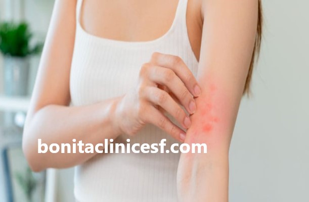 بیماری اگزمای پوستی چیست؟ | کلینیک بنیتا اصفهان