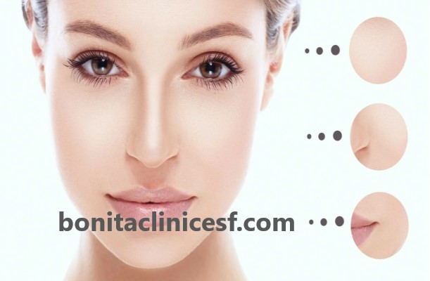 هزینه جوانسازی پوست با هایفو در اصفهان چقدر است؟ | کلینیک بنیتا اصفهان