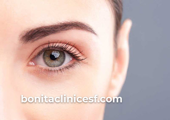 عمل بلفاروپلاستی مناسب چه افرادی است؟ | کلینیک بنیتا اصفهان