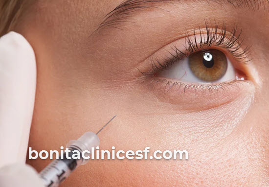 قیمت تزریق ژل به نقاط مختلف صورت چقدر است؟ | کلینیک بنیتا اصفهان