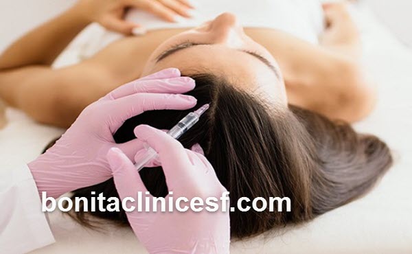 تاثیر مزوتراپی در ریزش مو | کلینیک بنیتا اصفهان