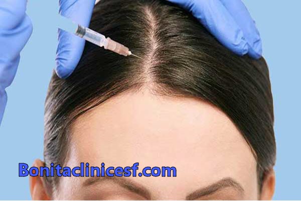 بهترین دکتر مزوتراپی در اصفهان | کلینیک بنیتا