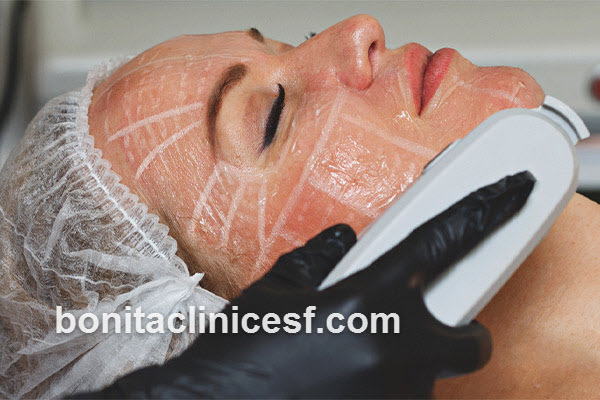 رفع غبغب و زاویه سازی فک با هایفوتراپی در اصفهان | کلینیک بنیتا اصفهان