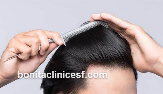 مرکز تخصصی کاشت مو به روش میکروگرافت در اصفهان | کلینیک بنیتا اصفهان