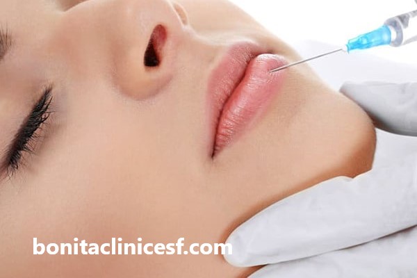 تزریق فیلر در بهترین کلینیک اصفهان | کلینیک بنیتا اصفهان