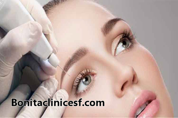 جراحی پلک با لیزر در اصفهان | کلینیک بنیتا اصفهان