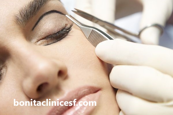 بلفاروپلاستی توسط پزشکان متخصص | کلینیک بنیتا اصفهان
