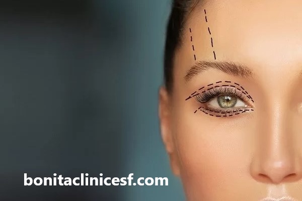 قیمت بلفاروپلاستی پلک پایین در اصفهان چقدر است؟ | کلینیک بنیتا اصفهان