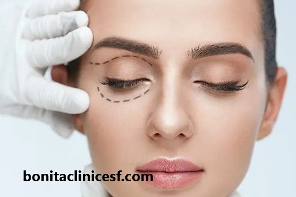 قیمت بلفاروپلاستی پلک پایین | کلینیک بنیتا اصفهان