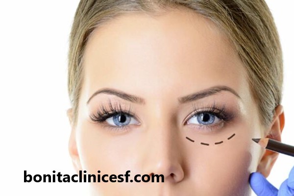 بهترین مرکز تخصصی بلفاروپلاستی در اصفهان | کلینیک بنیتا اصفهان