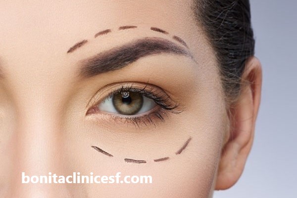 مراقبت های بعد از عمل بلفاروپلاستی پلک پایین | کلینیک بنیتا اصفهان