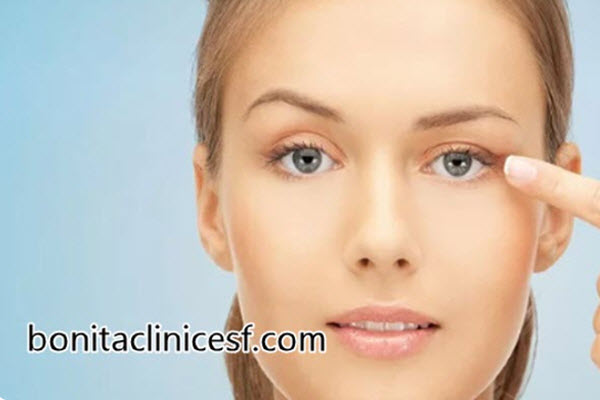 افتادگی پلک بعد از بوتاکس | کلینیک بنیتا اصفهان