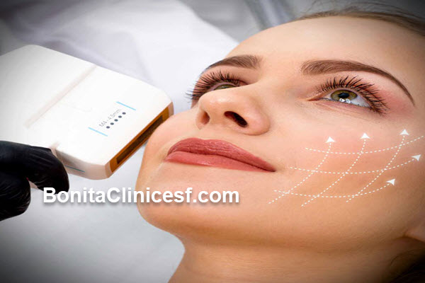 مدت زمان انجام هایفو صورت چقدر است؟ | کلینیک بنیتا اصفهان