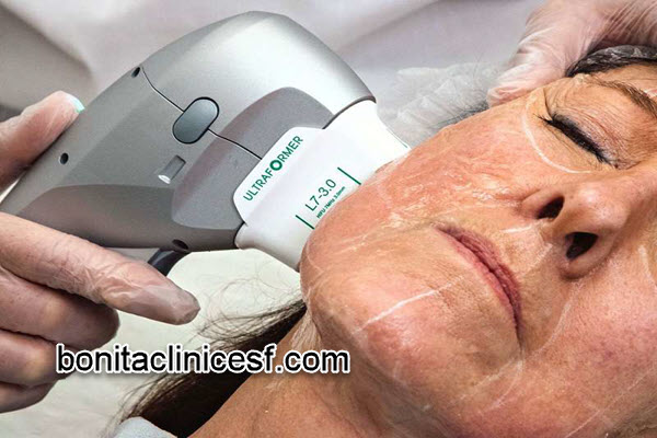 از چه سنی میتوان هایفو انجام داد؟ | کلینیک بنیتا اصفهان