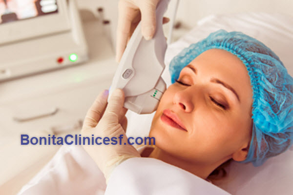 مدت زمان انجام هایفو صورت | کلینیک بنیتا اصفهان