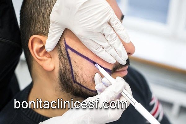 معتبر ترین پزشک کاشت ریش در کلینیک تخصصی - کلینیک بنیتا اصفهان