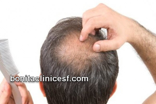 دلایل ریزش مو چیست؟ | کلینیک بنیتا اصفهان