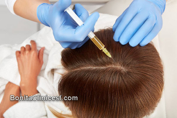 مزایای درمان ریزش مو توسط بهترین دکتر پی آر پی مو (PRP) در اصفهان | کلینیک بنیتا اصفهان