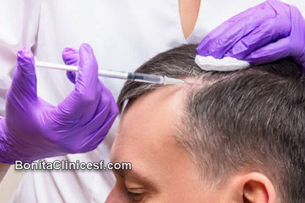 چه کسانی کاندیدای مناسبی برای انجام پی آر پی مو نیستند؟ | کلینیک بنیتا اصفهان