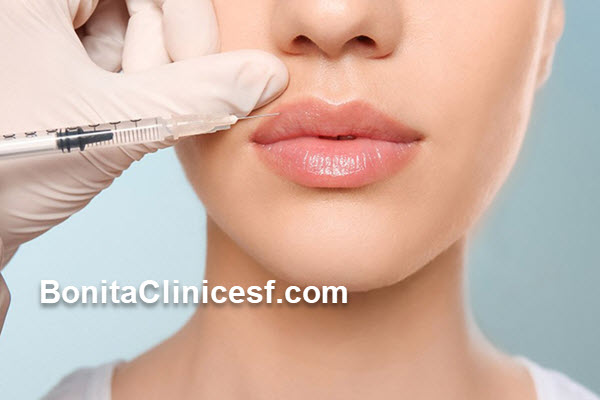 بهترین پزشک تزریق ژل لب روسی در اصفهان | کلینیک بنیتا اصفهان