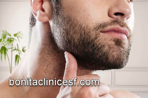 کاشت ریش توسط بهترین پزشک | کلینیک بنیتا اصفهان