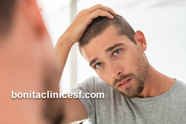 کاشت هر تار مو در اصفهان چقدر است؟ | کلینیک بنیتا اصفهان