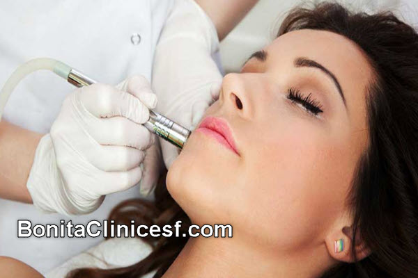 آر اف برای مناسب چه کسانی است؟ | کلینیک بنیتا اصفهان