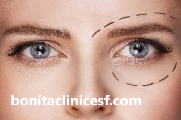 نکات مهم در انتخاب دکتر تزریق فیلر زیر چشم | کلینیک بنیتا اصفهان