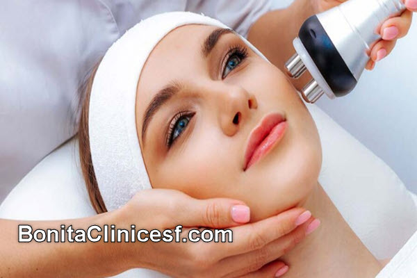سفت کردن پوست صورت و گردن با آر اف فرکشنال | کلینیک بنیتا اصفهان