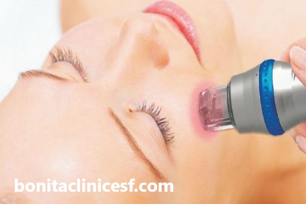 درمان پوست با فرکشنال رادیوفرکانس در اصفهان | کلینیک بنیتا اسفهان