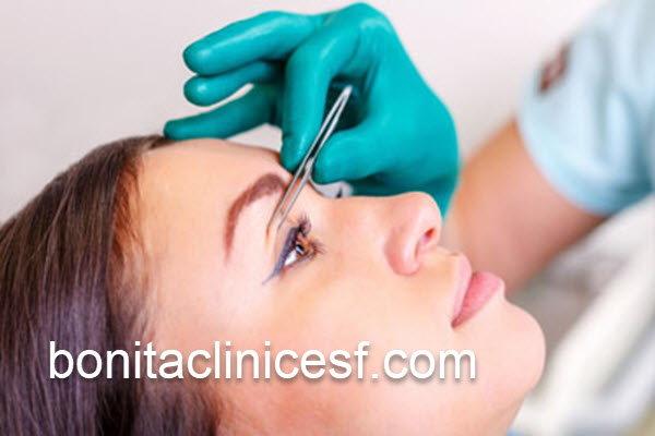 دکتر معتبر برای جراحی بلفاروپلاستی | کلینیک بنیتا اصفهان