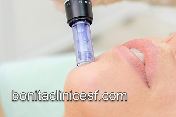 آگاهی از مراقبت های پس از میکرونیدلینگ |کلینیک بنیتا اصفهان