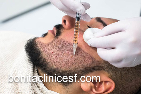 کاشت ریش و سبیل دائمی با بهترین قیمت در اصفهان | کلینیک بنیتا اصفهان