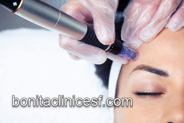 نکات مهم پس از میکرونیدلینگ | کلینیک بنیتا اصفهان