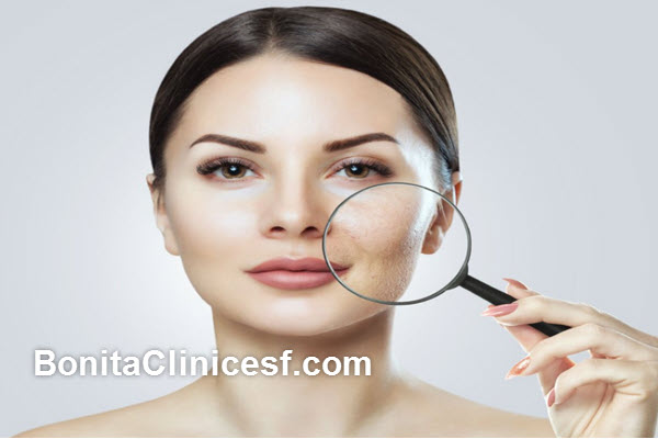 بهترین کلینیک برداشتن اسکارهای پوستی در اصفهان | کلینیک بنیتا اصفهان