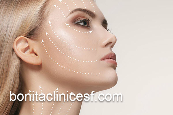 لیفت صورت با روش های بدون جراحی | کلینیک بنیتا اصفهان