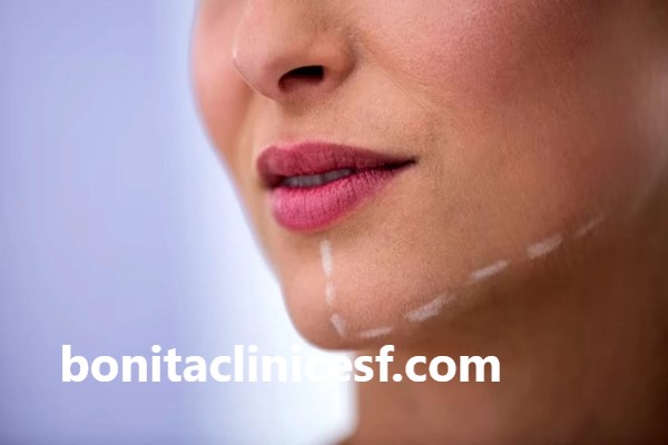 بهترین دکتر ساکشن غبغب در اصفهان | کلینیک بنیتا