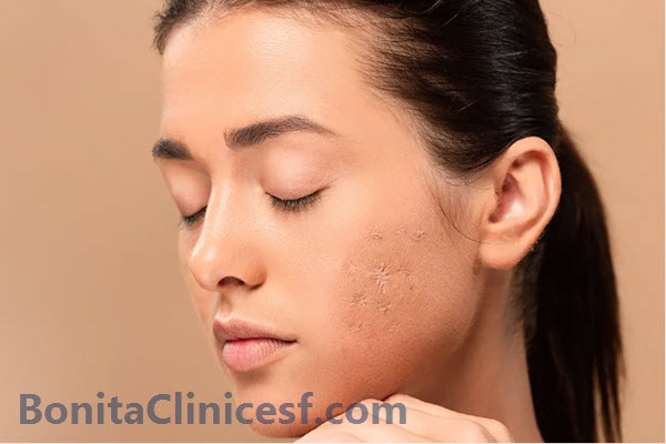 اسکار پوست چیست؟