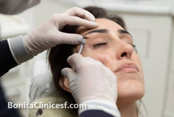 بوتاکس مصپورت چیست؟