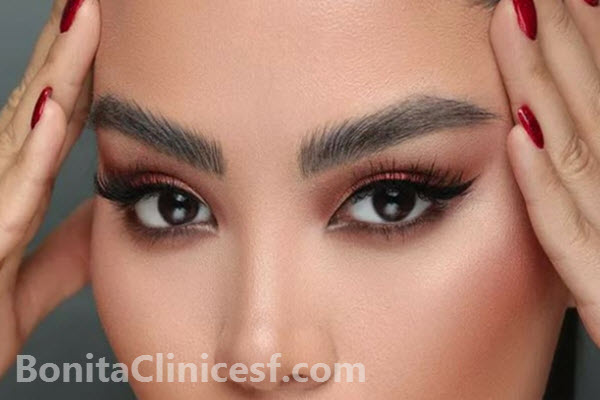 کاشت ابرو چیست؟