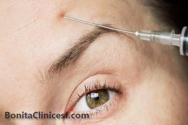 بوتاکس چیست؟