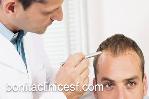 رفع ریزش مو در بهترین مرکز لیزر فوتونا | کلینیک بنیتا اصفهان