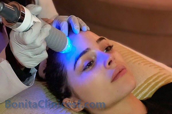 مراقبت های لازم بعد از ار اف فرکشنال