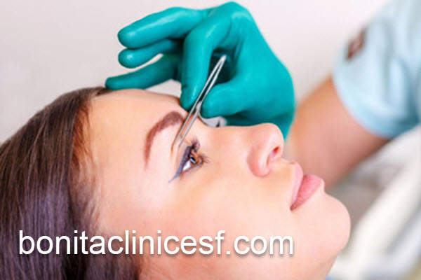 جراحی بلفاروپلاستی پلک بالا با بهترین قیمت | کلینیک بنیتا اصفهان