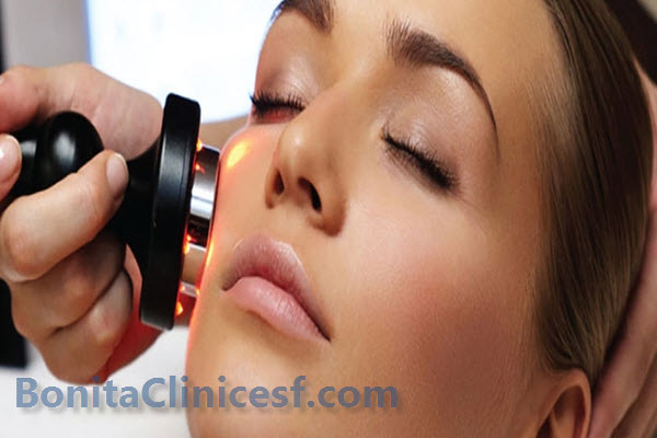 رفع افتادگی پوست با آر اف فرکشنال در اصفهان