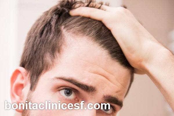 معرفی روش های کاشت مو | کلینیک بنیتا اصفهان