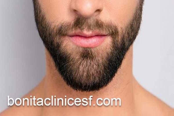 کاشت ریش با بهترین قیمت در اصفهان | کلینیک بنیتا اصفهان